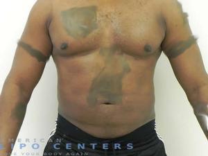americanlipocenters_12.jpg